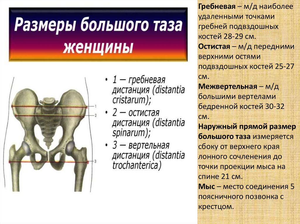 Точка удалена. Гребни подвздошных костей. Ость подвздошной кости. Межвертельный размер. Наружные края передне верхних остей подвздошных костей.