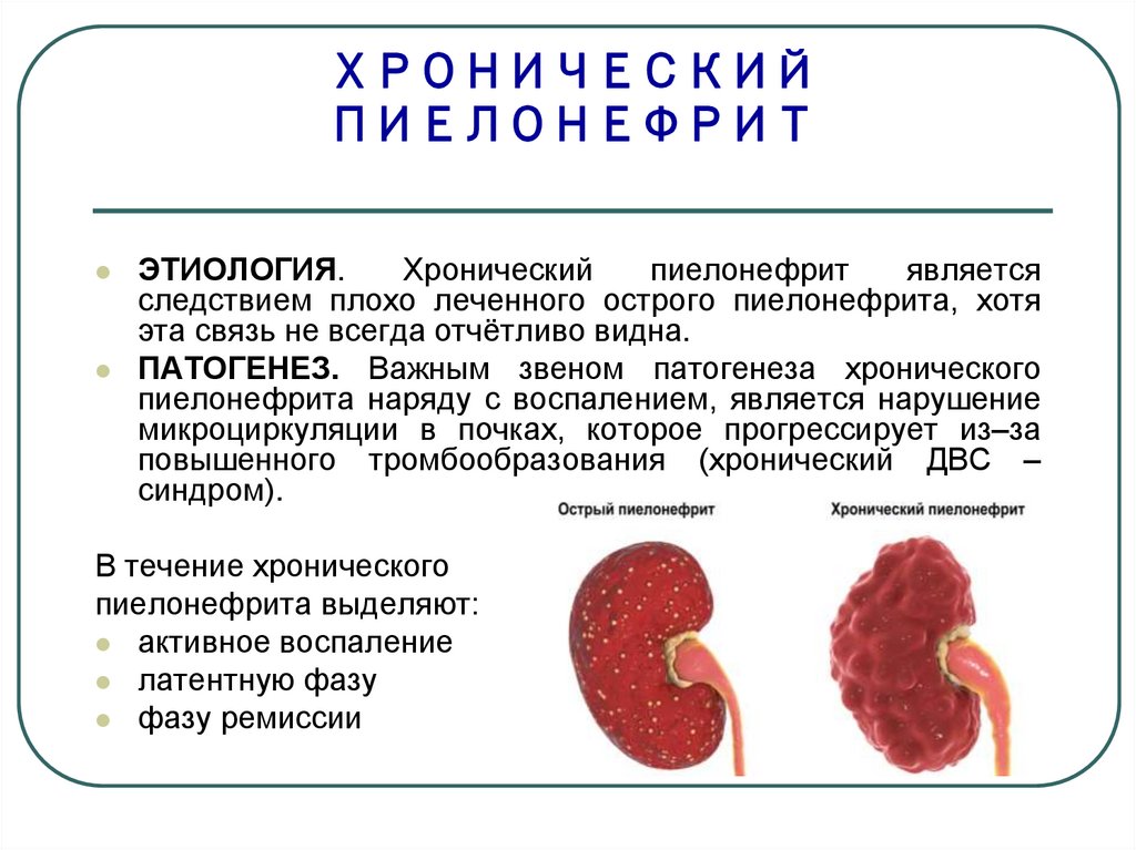 Особенности пиелонефрита