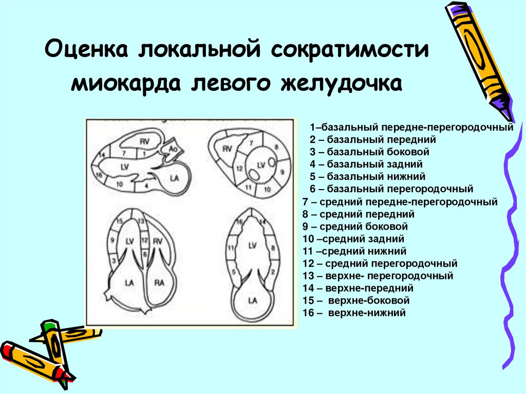 Ультразвуковая диагностика острого инфаркта миокарда и ее осложнений ...