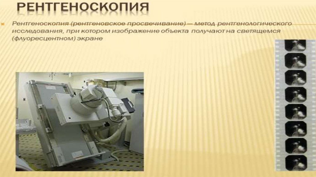 Рентгенологические методы исследования - презентация онлайн