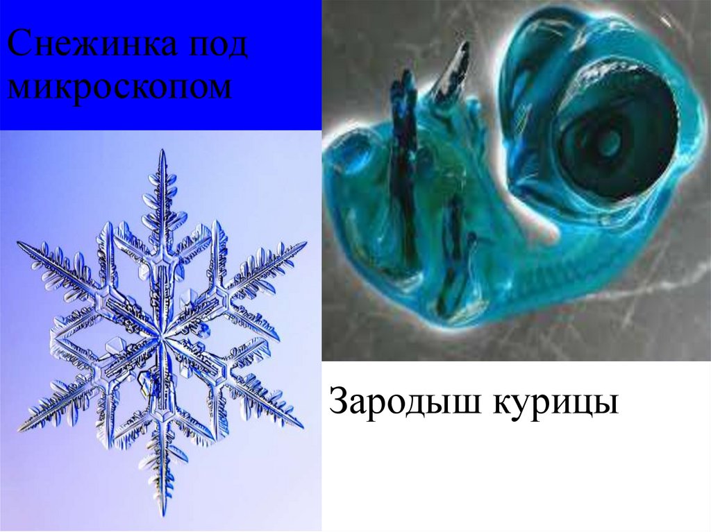 Снежинка под микроскопом