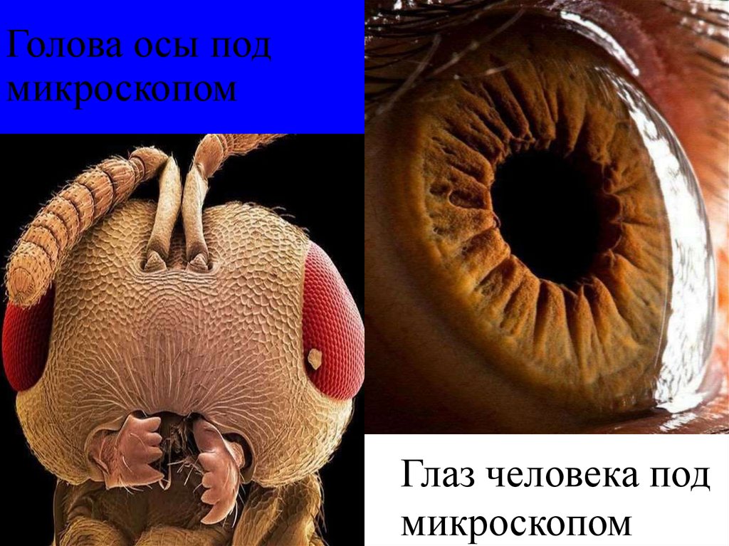 Голова осы под микроскопом