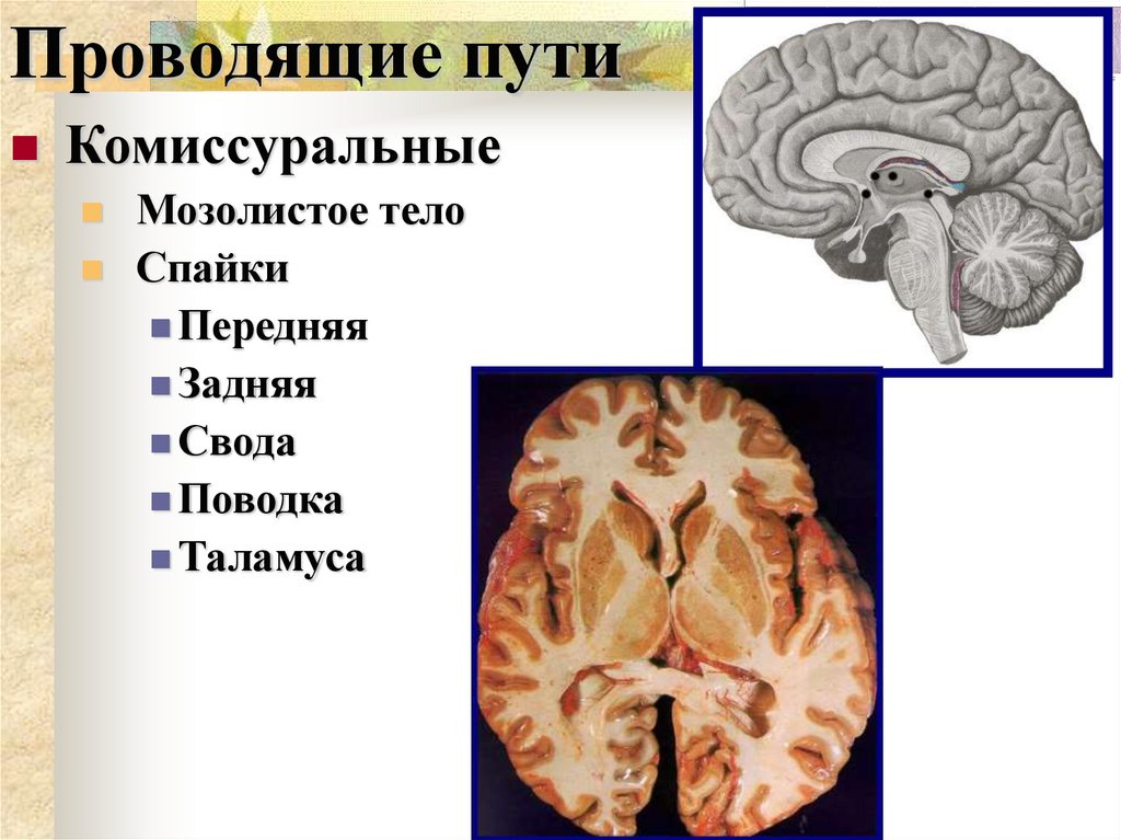 Проводящие пути