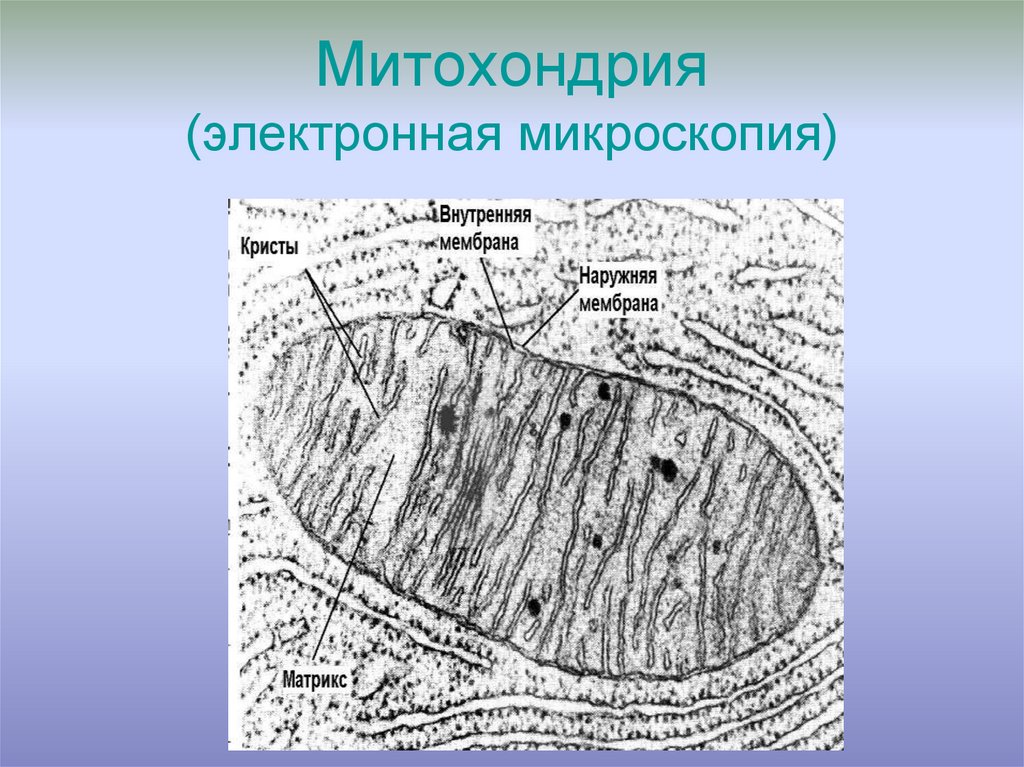 Органоиды микрофотографии. Митохондрии электронно-микроскопическое строение. Электрономикроскопическое строение митохондрии. Строение митохондрии Электронограмма. Строение митохондрий световой микроскоп.