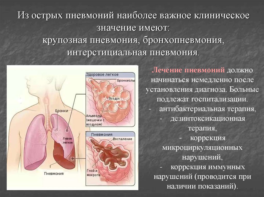 Мокроты при пневмонии у взрослых. Осложнения при крупозной пневмонии. Клинические проявления крупозной пневмонии. Крупозная пневмония характер мокроты. Пневмония внутренние болезни презентация.