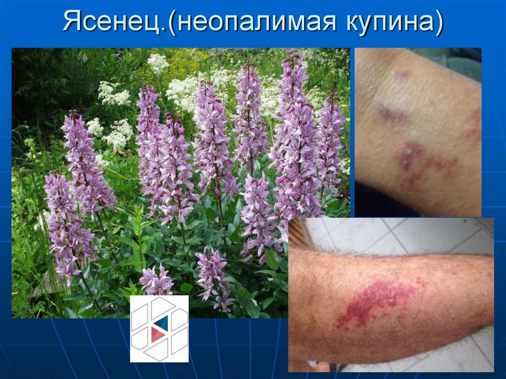 Ясенец.(неопалимая купина)