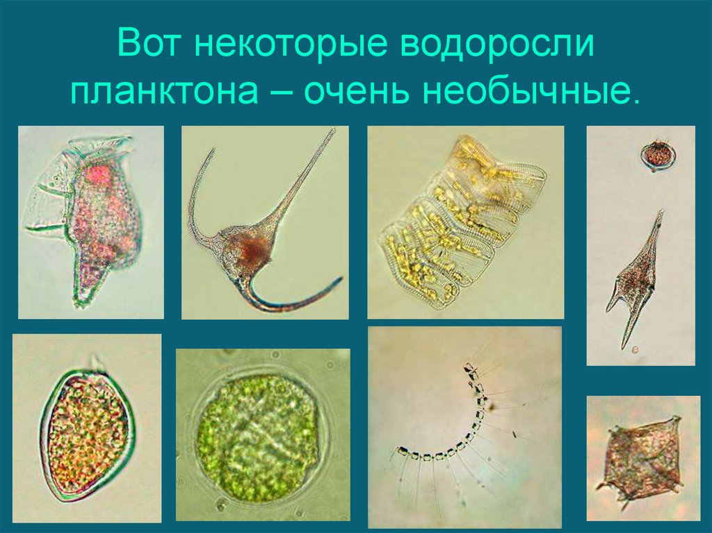 Фитопланктон дать определение. Одноклеточные планктонные водоросли. Планктонные водоросли представители. Планктонные микроводоросли. Одноклеточный планктон.