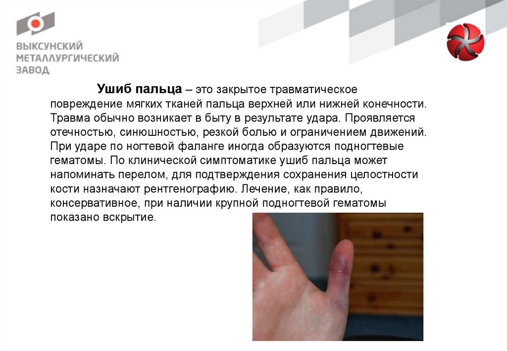Бытовая травма. Ушиб пальца на руке - презентация онлайн