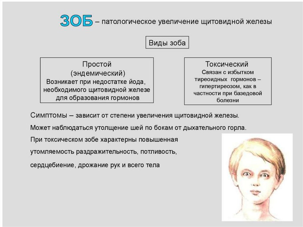 Зоб риделя презентация