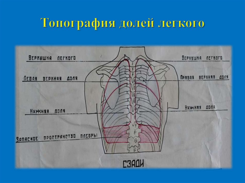 Границы легких картинка