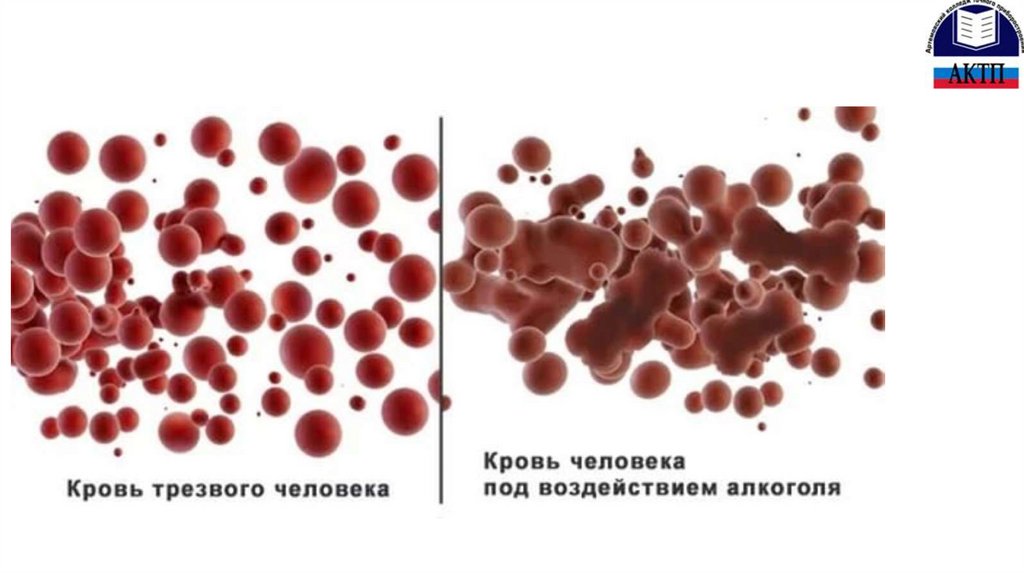Как пахнет кровь. Кровь человека под микроскопом. Густая кровь и нормальная. Кровь трезвого человека кровь пьющего человека.