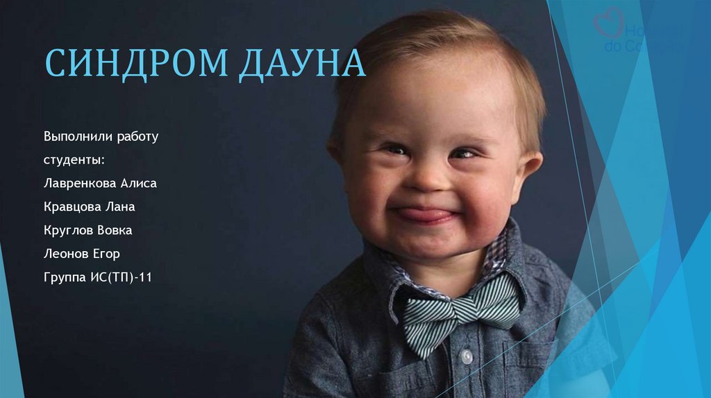 Синдром Дауна - презентация онлайн