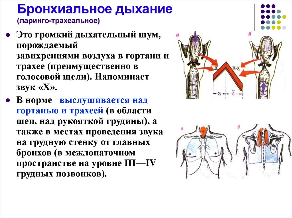 Амфорическое дыхание это. Бронхиальное дыхание аускультация.