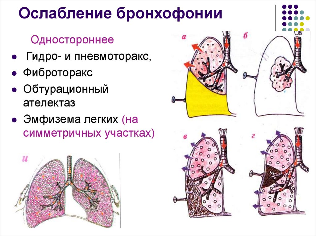 Усиление ослабление