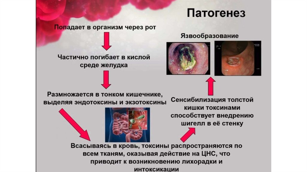 Дизентерия - презентация онлайн