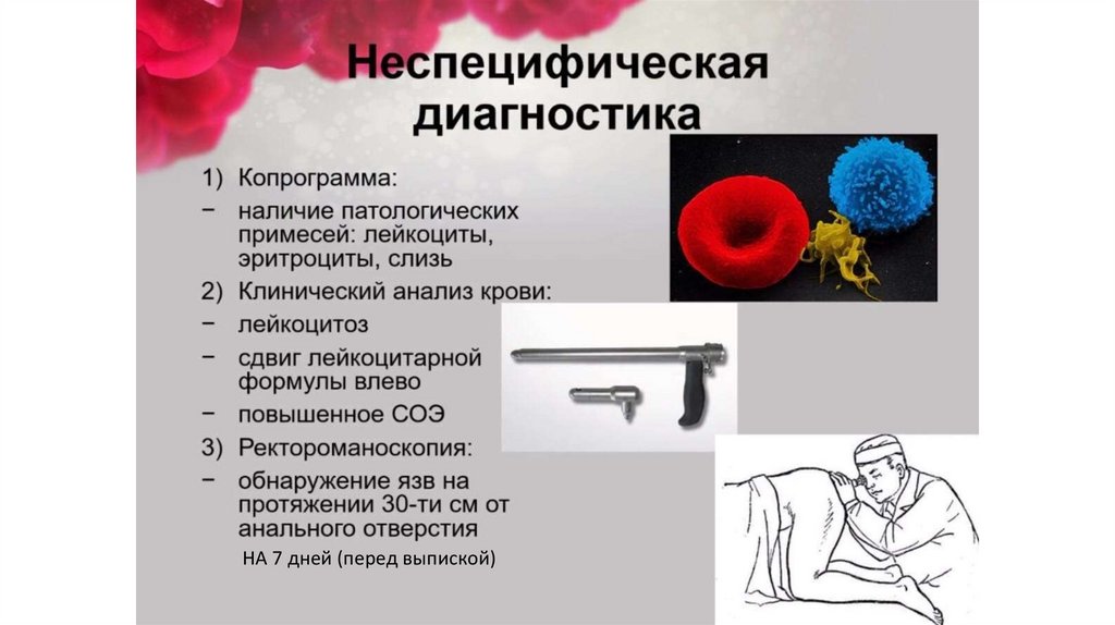 Дизентерия - презентация онлайн