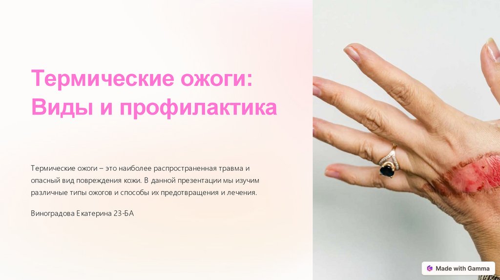 Термические ожоги: виды и профилактика - презентация онлайн