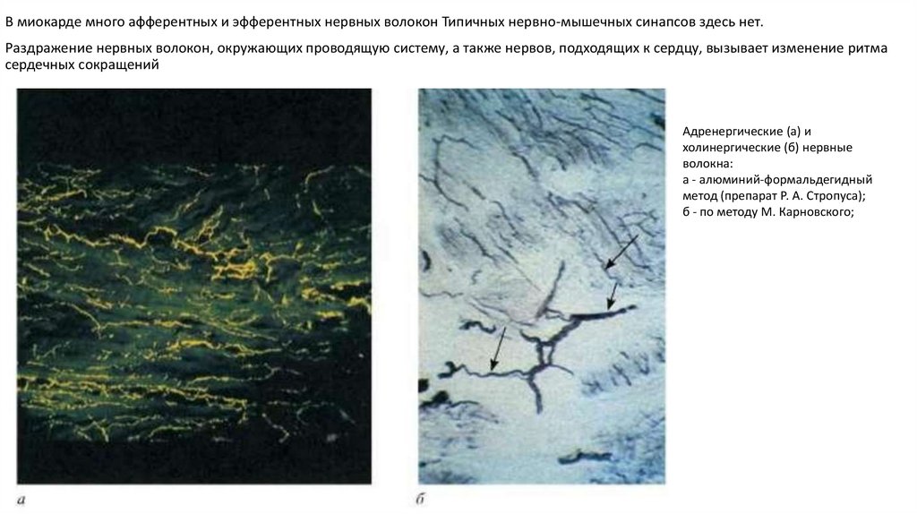 Кардиомиоциты проводящей системы сердца (по П. П. Румянцеву ...