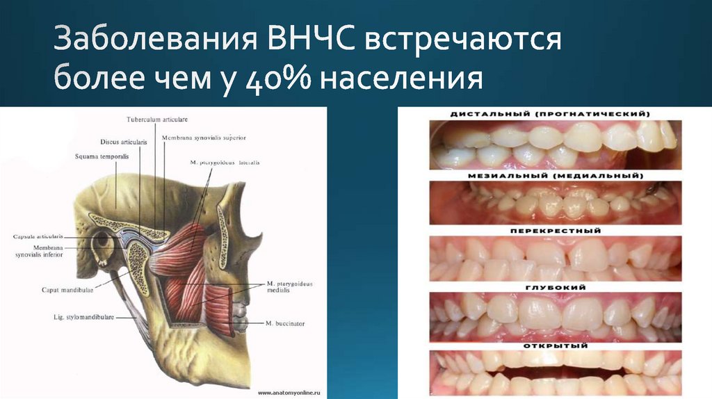 Суставная диагностика - или почему щёлкает сустав - презентация онлайн