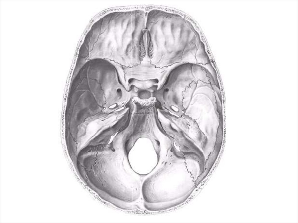 Мозговое основание черепа. Перелом костей передней черепной ямки. Черепные ямки анатомия внутреннее основание черепа. Перелом основания черепа анатомия. Основание черепа Черепные ямки.