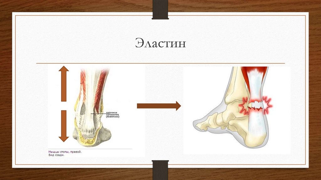 Сухожилие - презентация онлайн