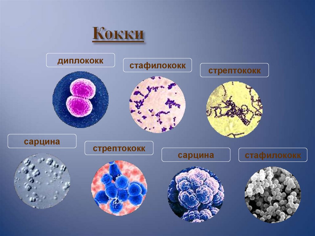 Стрептококк относится к эукариотам. Кокки ланцетовидной формы. Шарообразные клетки. Диплококки шаровидные микроорганизмы. Кокки диплококки.