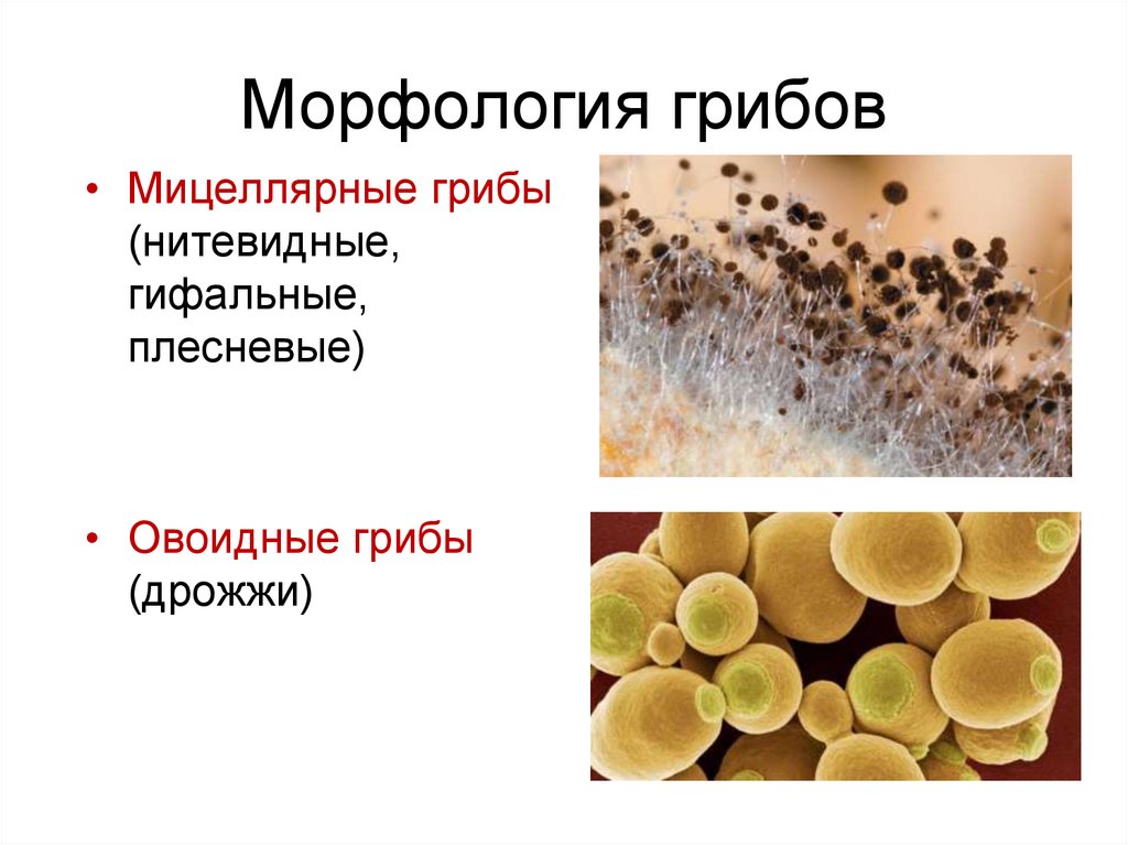 Плесневелые грибы примеры. Морфология грибов. Грибы морфология. Blakeslea trispora морфология гриба. Морфологически грибы рода Malassezia – это.