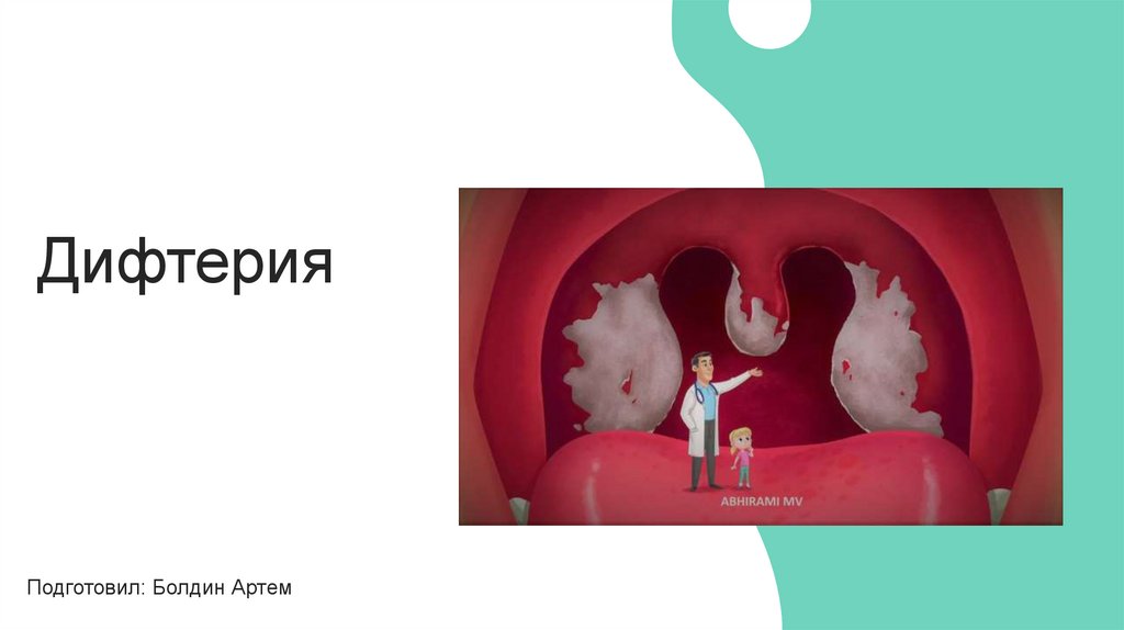 Дифтерия - презентация онлайн