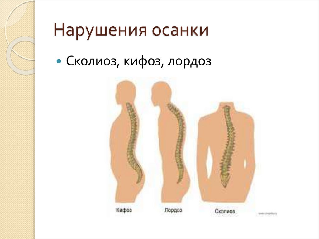 Корригирующая гимнастика на уроках физической культуры - презентация онлайн
