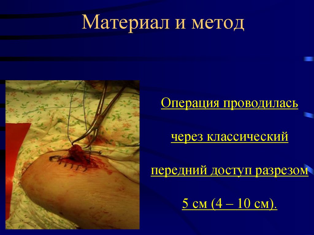 Материал и метод