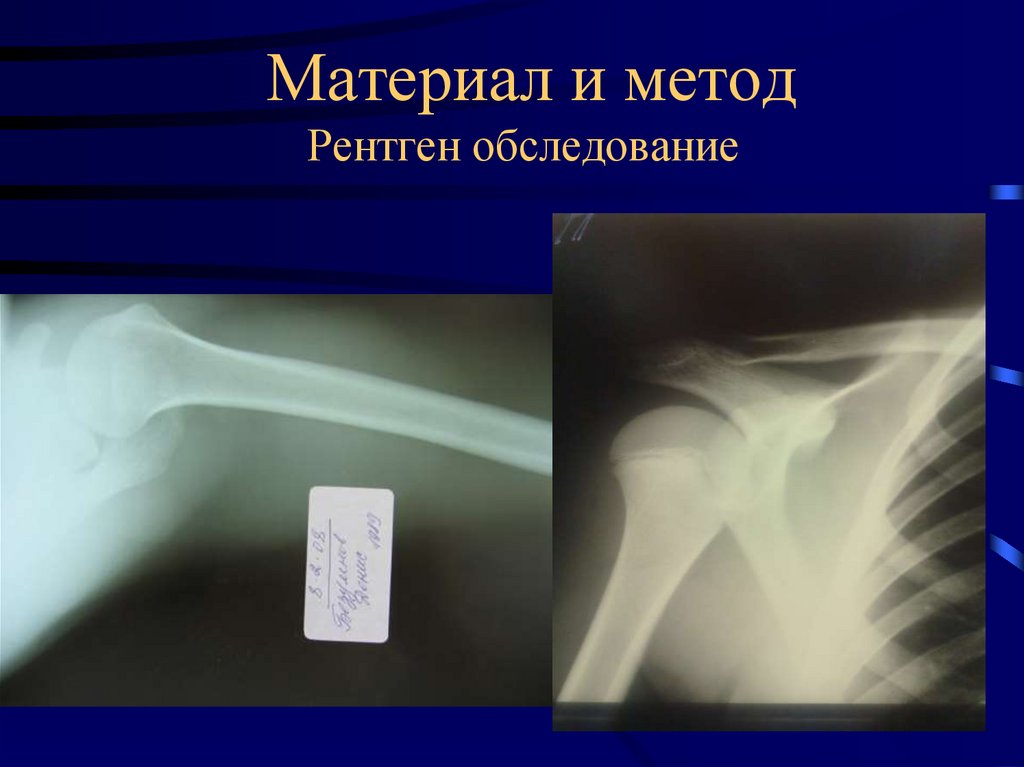 Материал и метод Рентген обследование