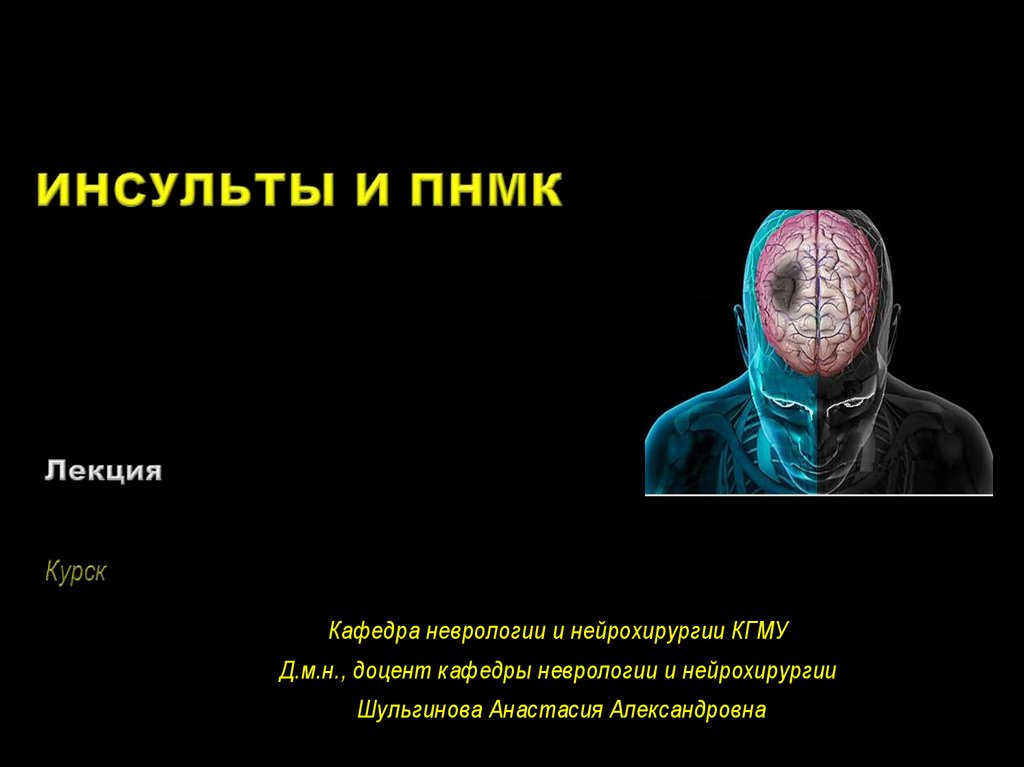Инсульты и преходящие НМК - презентация онлайн
