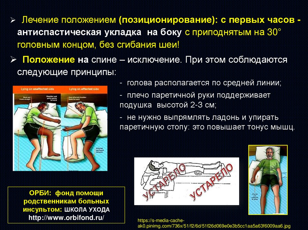 Инсульты и преходящие НМК - презентация онлайн
