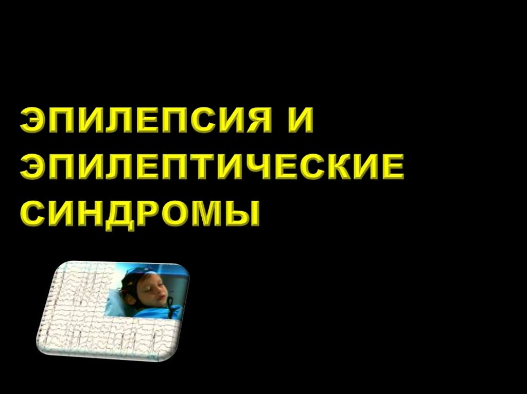 Инсульты и преходящие НМК - презентация онлайн