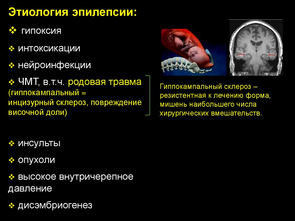 Инсульты и преходящие НМК - презентация онлайн