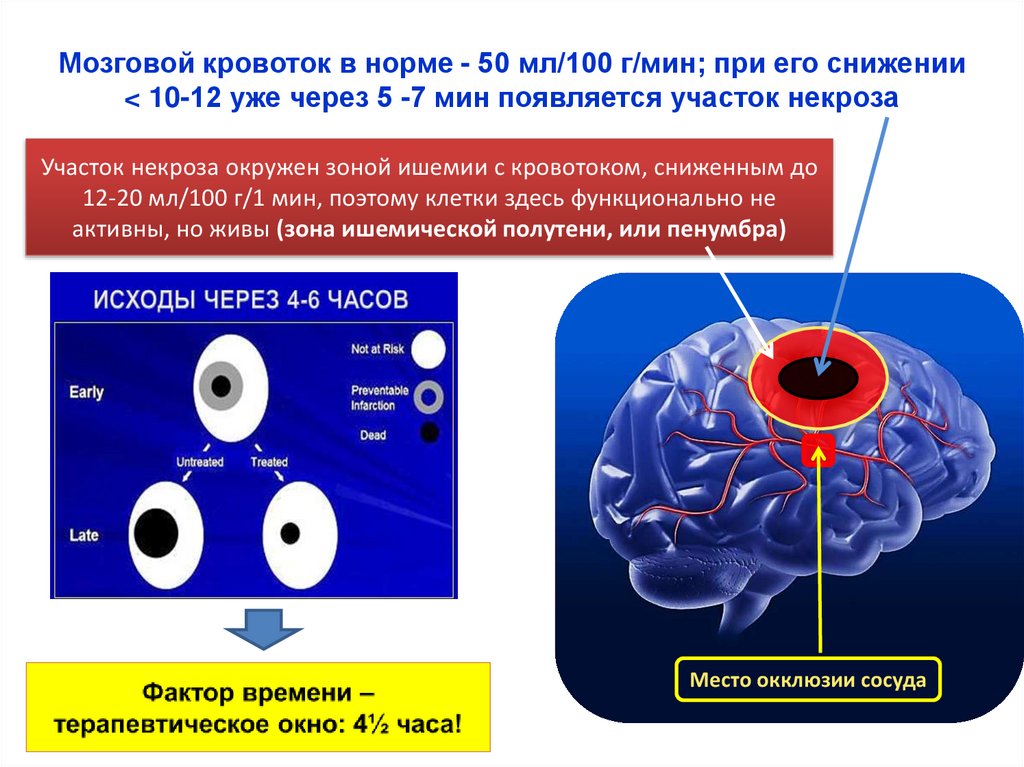 Инсульты и преходящие НМК - презентация онлайн