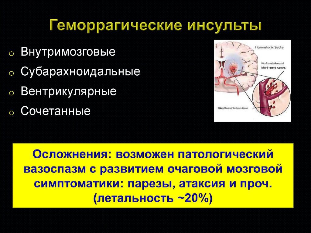 Инсульты и преходящие НМК - online presentation