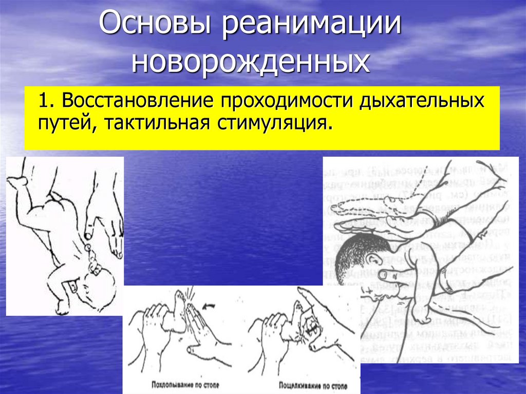 Первая помощь сердечно легочная реанимация обж 10 класс презентация