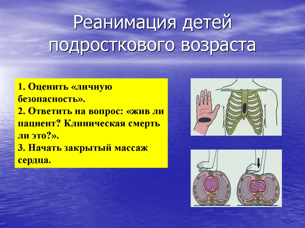 Слр у детей презентация