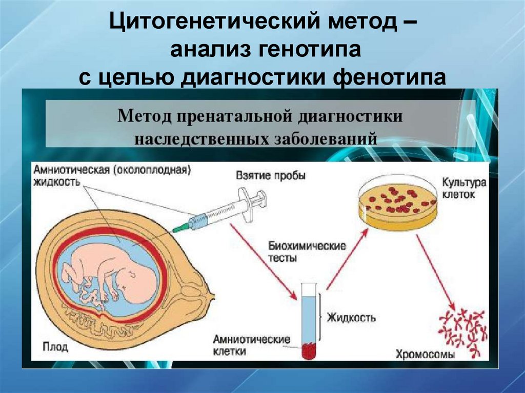 Цитогенетический метод – анализ генотипа с целью диагностики фенотипа