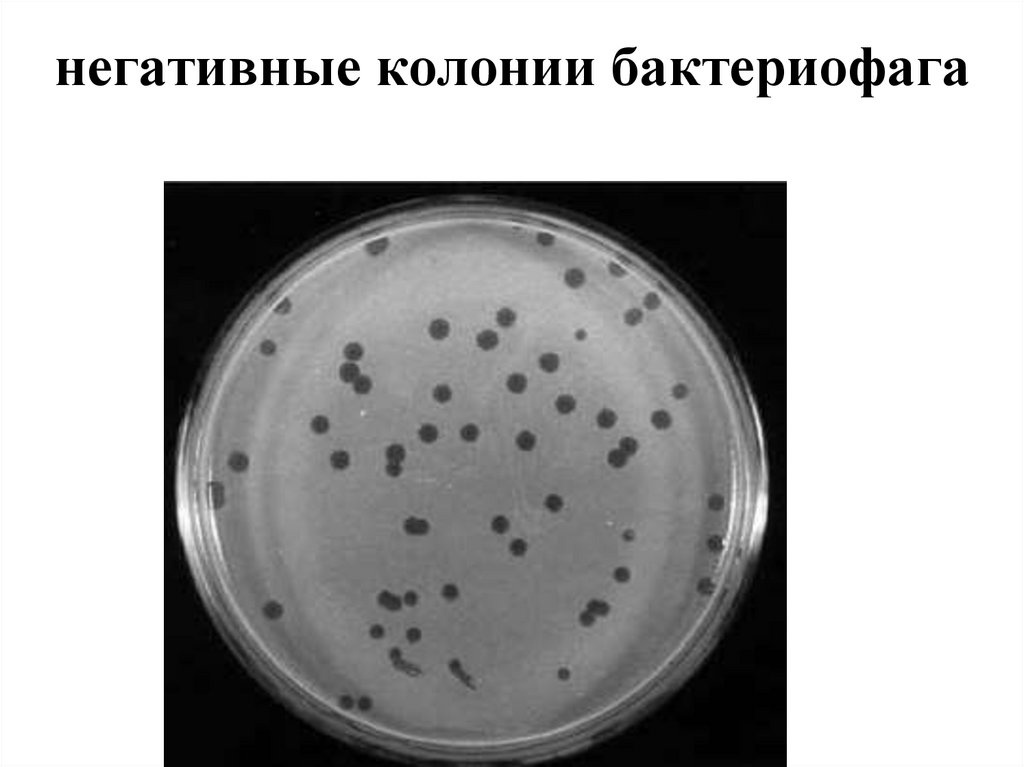 негативные колонии бактериофага