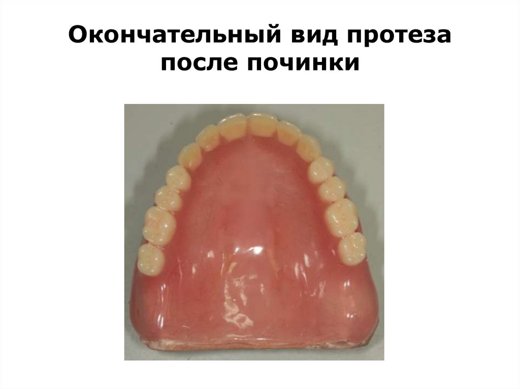 Окончательный вид протеза после починки