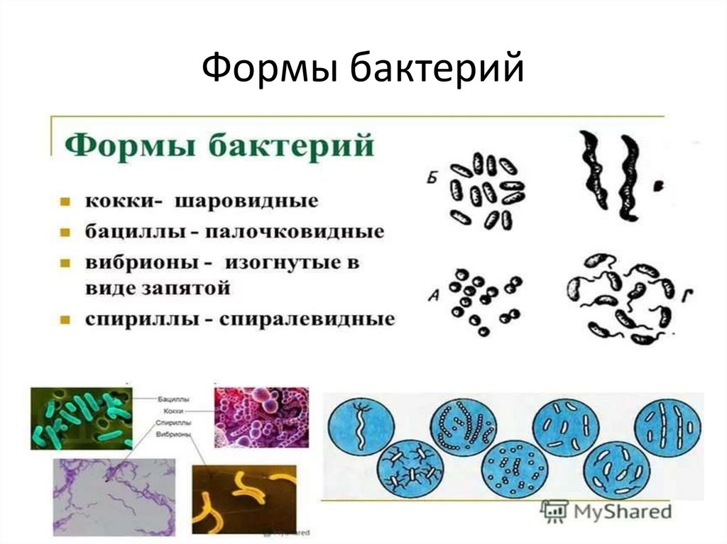 Самостоятельная работа бактерии 7 класс. Формы бактерий. Подвижные формы бактерий. Бактерии завиток формы. 4 Формы бактерий.