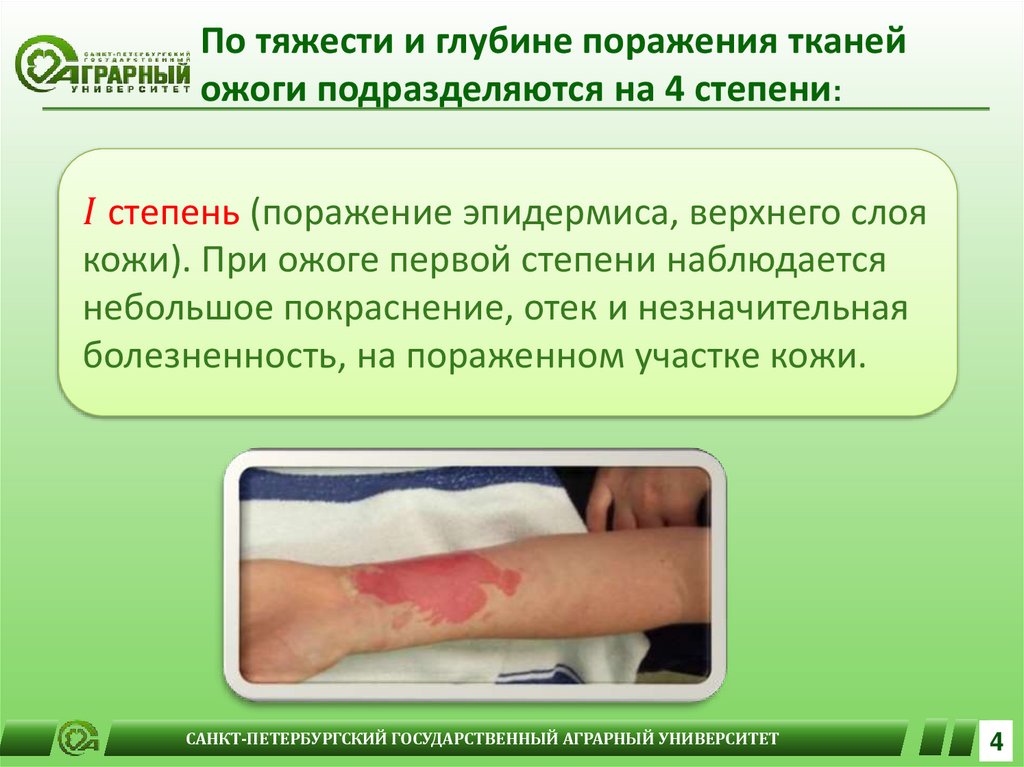 Первая помощь при химическом ожоге - презентация онлайн