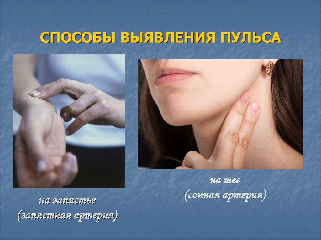 СПОСОБЫ ВЫЯВЛЕНИЯ ПУЛЬСА