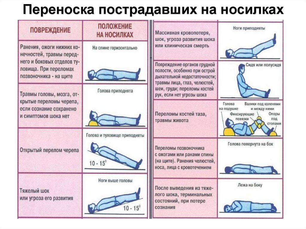 Виды транспортировки пострадавших презентация