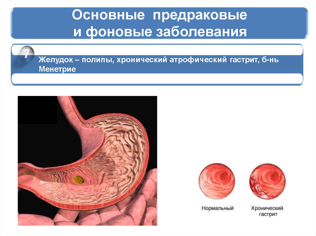 Общий рак