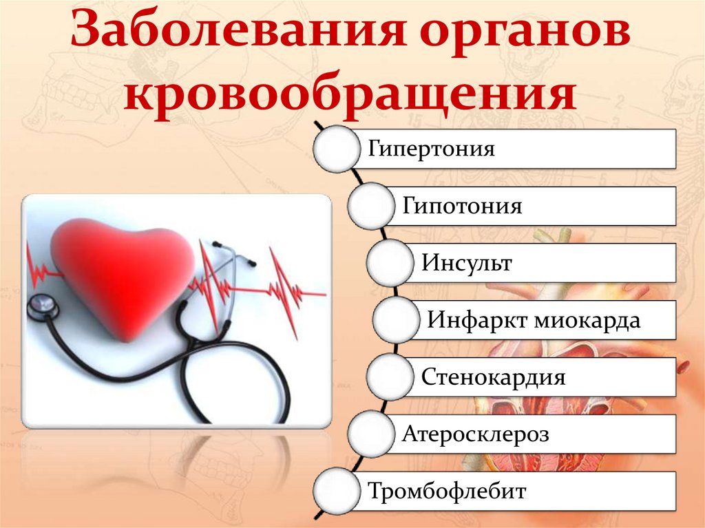 Диагнозы сердечно сосудистой системы. Заболевания сердечно-сосудистой системы. Болезни системы кровообращения. Профилактика болезней системы кровообращения. Заболевания сердечно сосудистой системы их предупреждение.