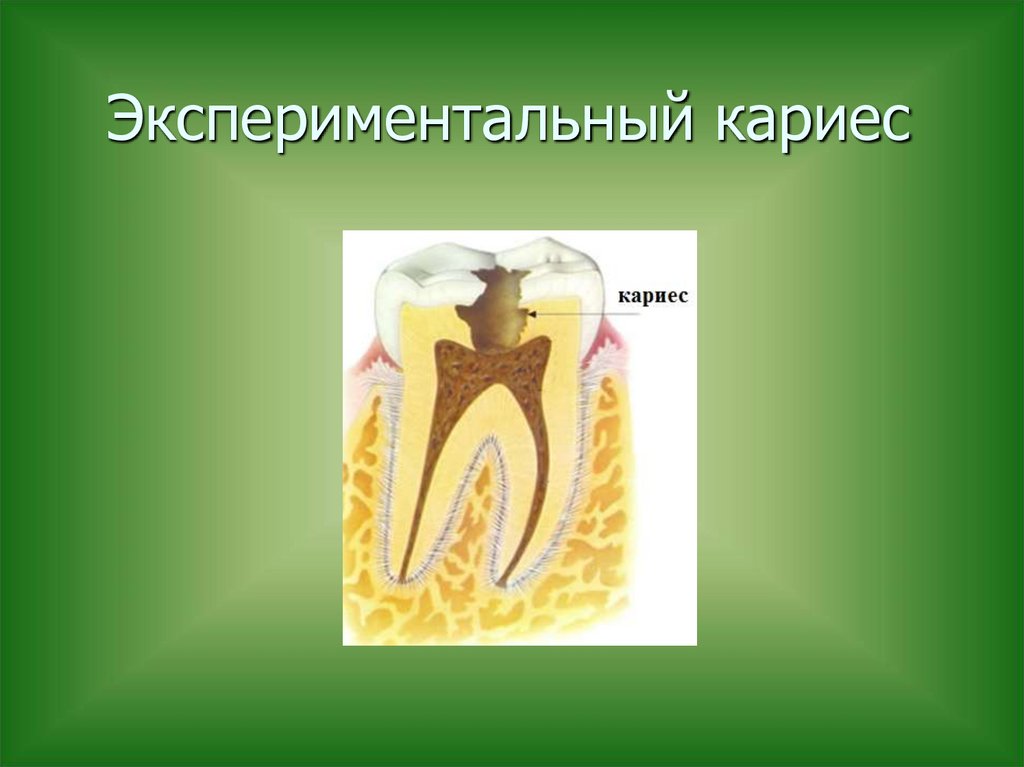 Экспериментальный кариес
