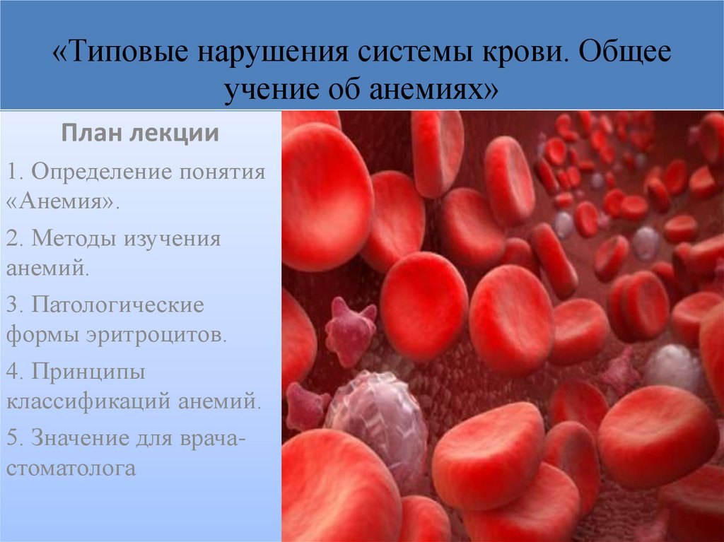 Понятие анемии. Тмрвые нарушения система крови. Анемия лекция. Лекция по анемии. Анемия крови презентация.